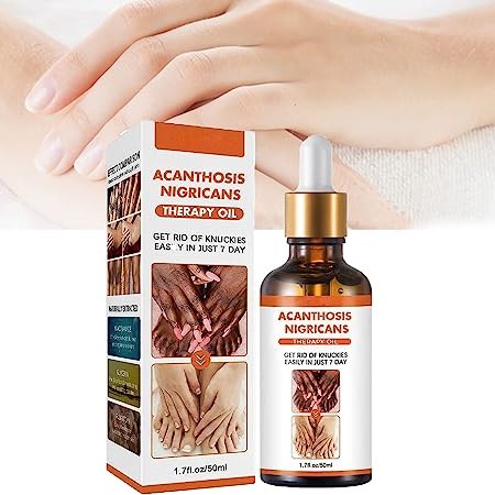 Acanthosis Nigricans Therapy Oil